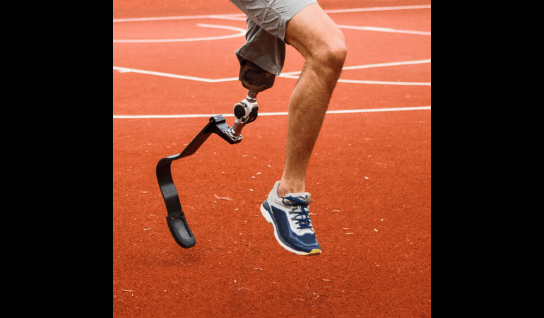 Artificial Leg Price in India - Limbgenixx Blog